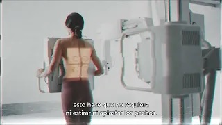 Basta de aprietes: un mamógrafo sin dolor